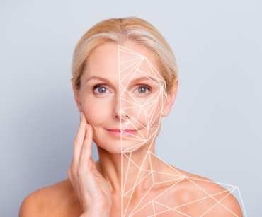 Traitement laser Genesis de Cutera®