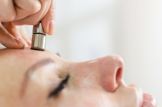 Microdermabrasion